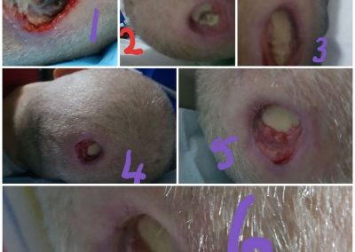 stages of wound healing
