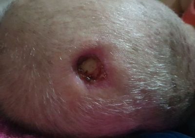 Wound Healing